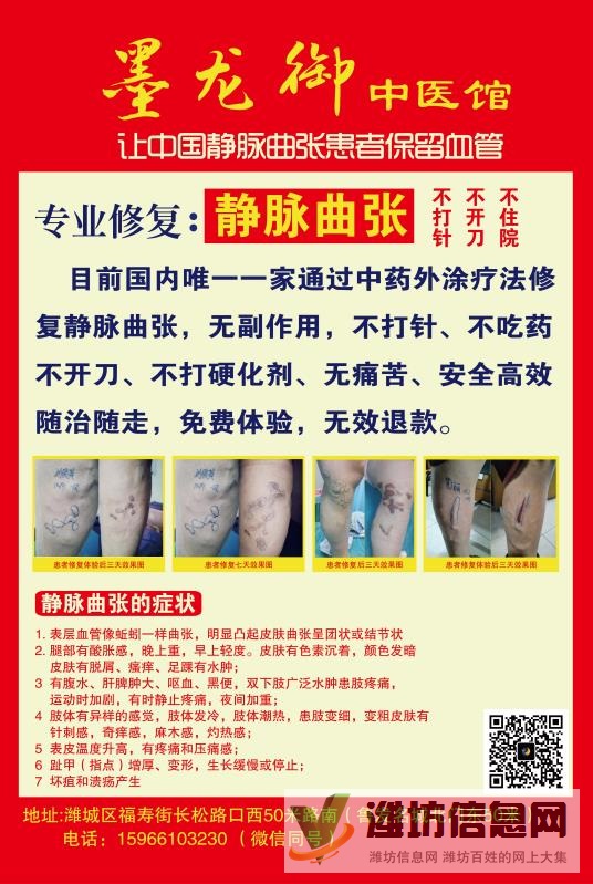 墨龍御靜脈曲張修復(fù)